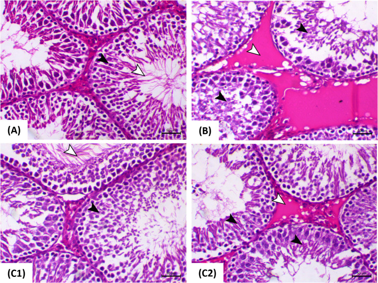 Quercetin-mediated restoration of high-fat diet-induced male reproductive dysfunction through modifying spermatogenesis and unraveling 3β-HSD, 17β-HSD, and StAR pathways.
