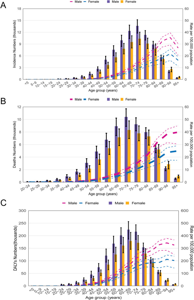 Global, regional, and national burden of multiple myeloma from 1990 to 2021 and projections for 2040: a systematic analysis for the global burden of disease 2021 study.