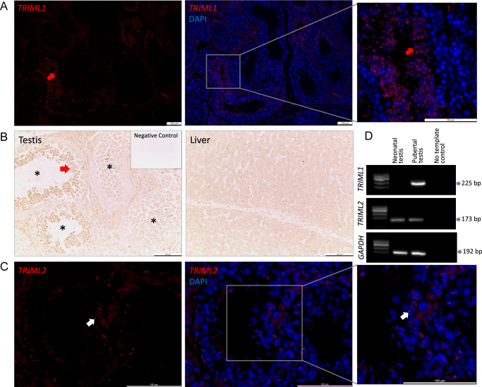Expression of tripartite motif family-like protein 1 and 2 in early conceptus development and placentation in the pig.