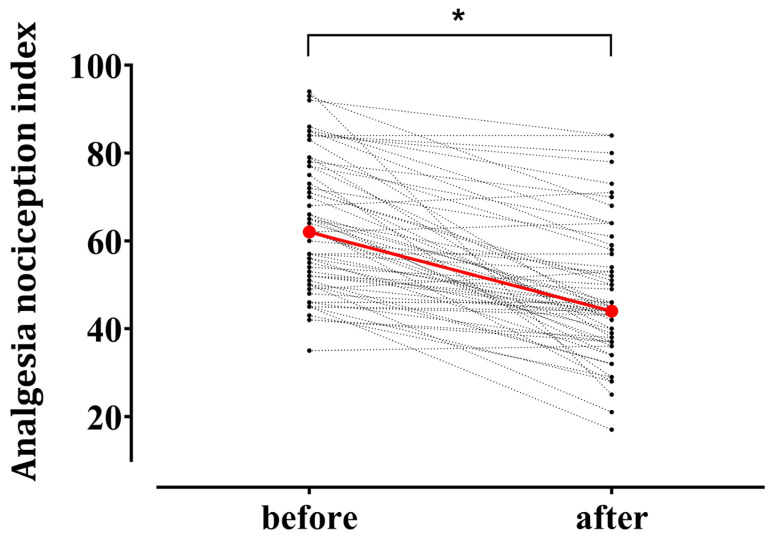 The Analgesia Nociception Index's Performance During Remimazolam-Based General Anesthesia: A Prospective Observational Study.