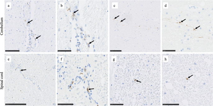 CSF Markers of TG6 Autoimmunity in Gluten Ataxia.