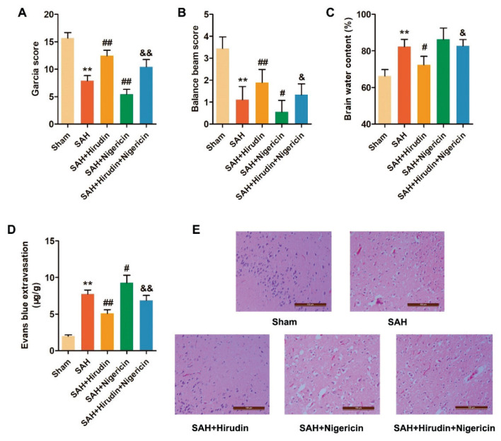 Hirudin Alleviates Early Brain Injury After Subarachnoid Hemorrhage in Rats via Regulating NLRP3 Inflammasome-Mediated Pyroptosis.