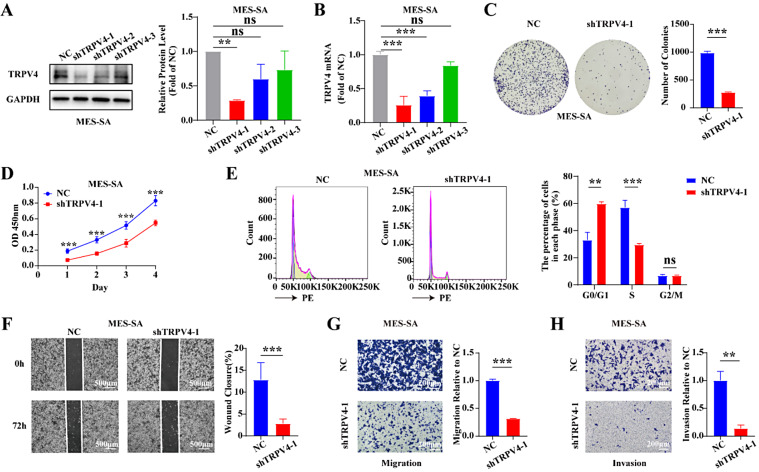TRPV4 drives the progression of leiomyosarcoma by promoting ECM1 generation and co-activating the FAK/PI3K/AKT/GSK3β pathway.