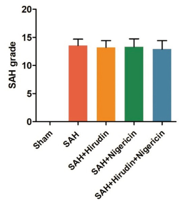 Hirudin Alleviates Early Brain Injury After Subarachnoid Hemorrhage in Rats via Regulating NLRP3 Inflammasome-Mediated Pyroptosis.