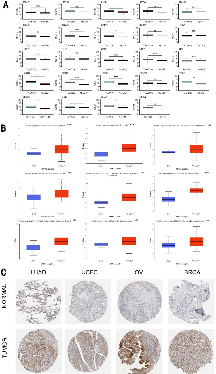Cohort-based pan-cancer analysis and experimental studies reveal ISG15 gene as a novel biomarker for prognosis and immunotherapy efficacy prediction.