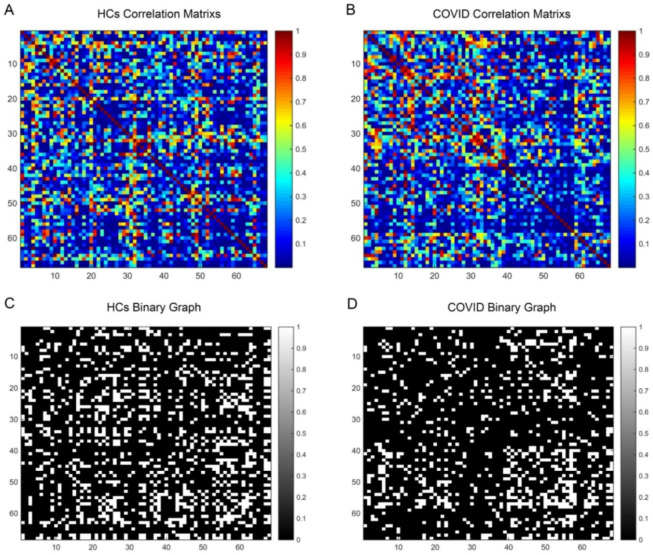 Multimodal MRI analysis of COVID-19 effects on pediatric brain.