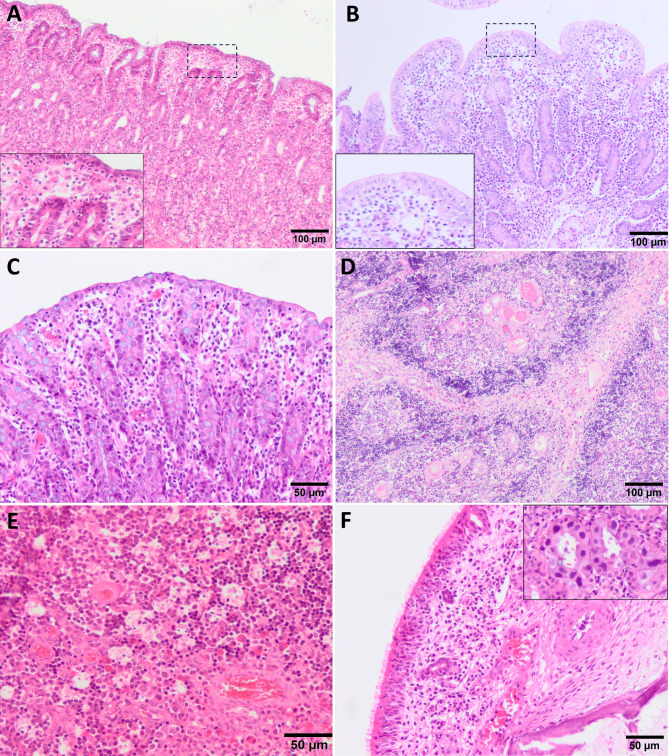Periweaning failure to thrive syndrome (PFTS): A growing concern in swine health.
