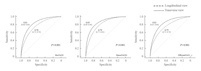 Deep Learning Technology for Classification of Thyroid Nodules Using Multi-View Ultrasound Images: Potential Benefits and Challenges in Clinical Application.