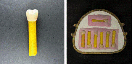 Bond strength between acrylic resin and artificial tooth treated with experimental silane with thio-urethane.