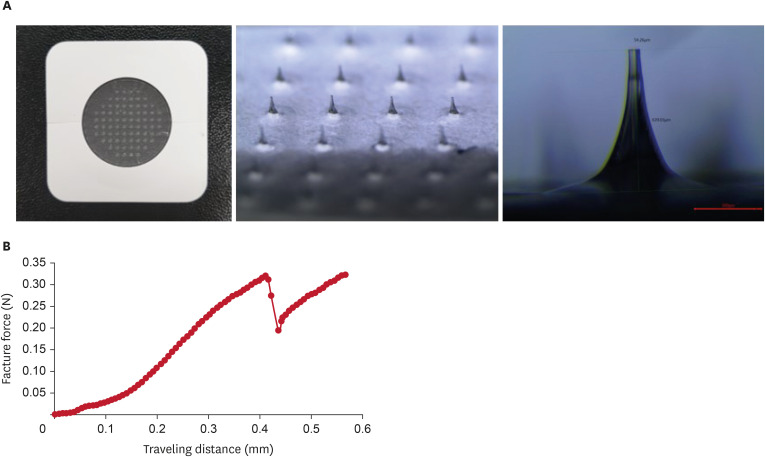Additional Use of Hyaluronic Acid-Based Dissolving Microneedle Patches to Treat Psoriatic Plaques: A Randomized Controlled Trial.
