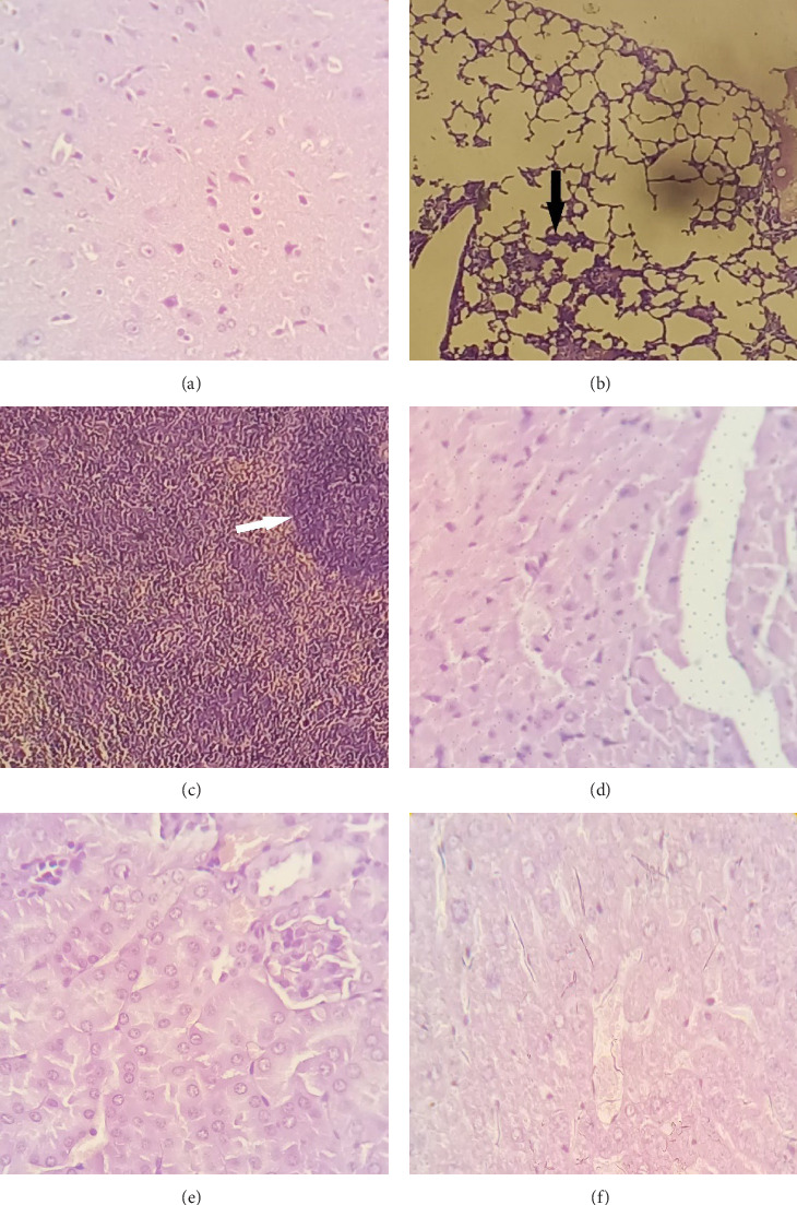 Omp34-Mediated <i>Acinetobacter baumannii</i> Invasion of Human Cervical Carcinoma Epithelial, HeLa Cells, and the Influence of Anti-Omp34 Antibodies.