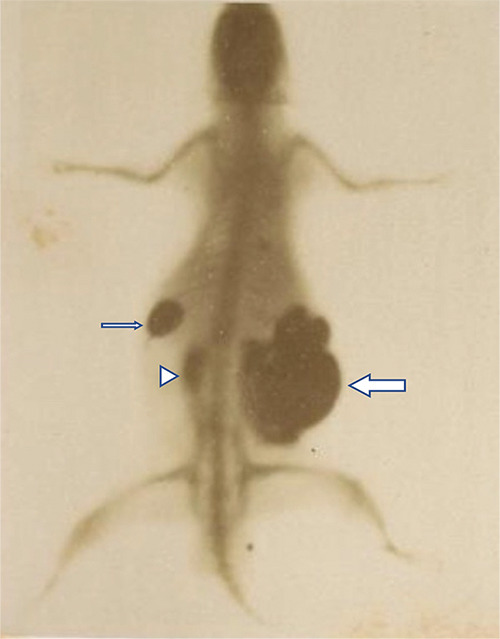 Rectification of Priority: Giuseppe Vicentini (1860-1944) Presented the First Luminal Contrast Enhanced X‑Ray of the Digestive Tract on January 26, 1896.