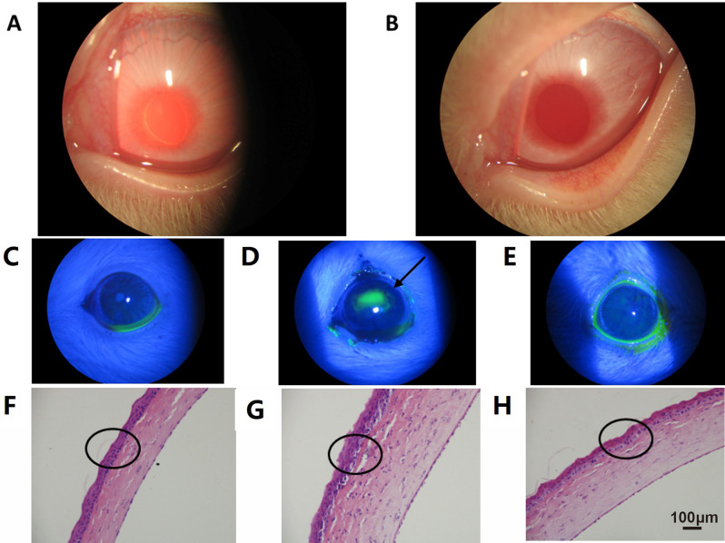Coenzyme Q10 microemulsion ion-activated gel: a promising ophthalmic delivery system for enhanced corneal protection and sustained release.