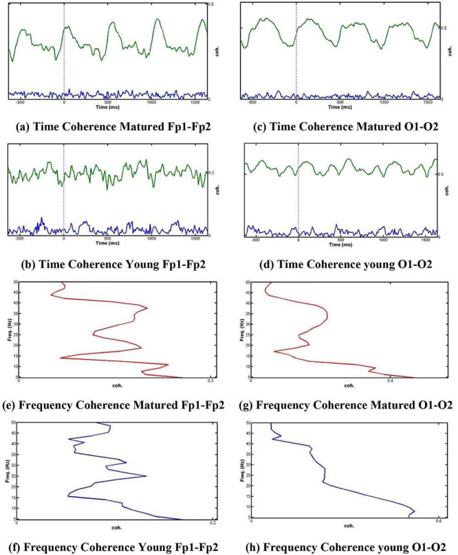 Age-Related Discrimination of Visual-Evoked Potentials Using Cross-Coherence Analysis.