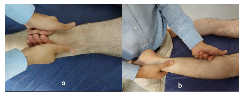 Sonographic Evaluation of the Superficial Back Line Myofascial Release in Plantar Fasciitis: A Single-Blind Randomized Controlled Trial.