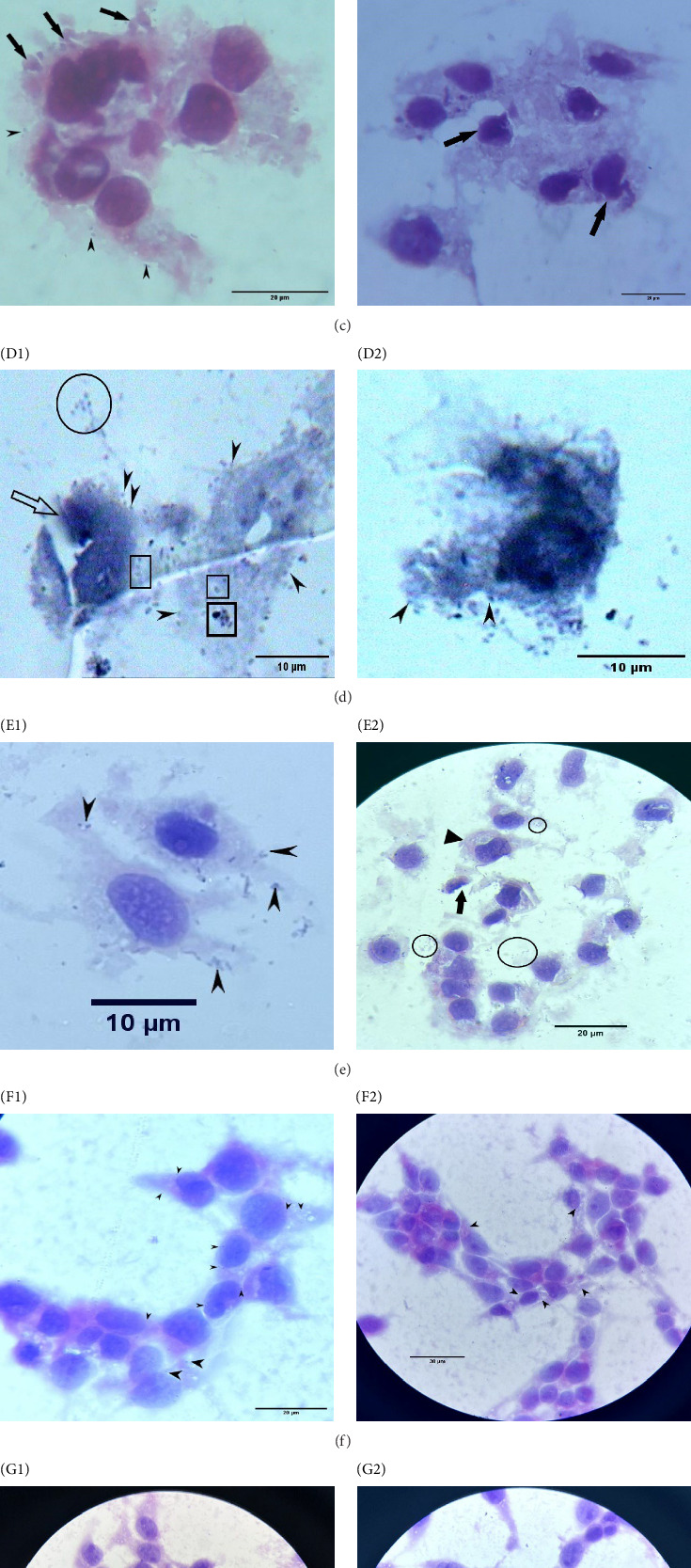Omp34-Mediated <i>Acinetobacter baumannii</i> Invasion of Human Cervical Carcinoma Epithelial, HeLa Cells, and the Influence of Anti-Omp34 Antibodies.