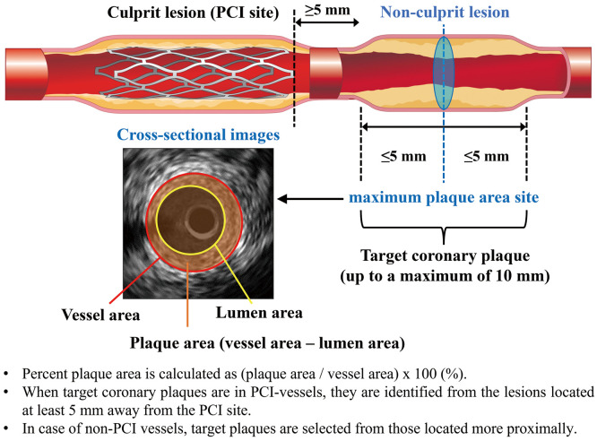 Effect of Intensified Multifactorial Treatments on Coronary Atherosclerosis in Patients With Coronary Artery Disease and Type 2 Diabetes Mellitus　- Rationale and Design of the Randomized IMPACT-DM Trial.