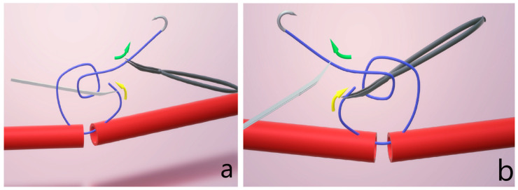 Microvascular Anastomosis in Practice: A Pilot Study on Microsurgical Training Efficiency.