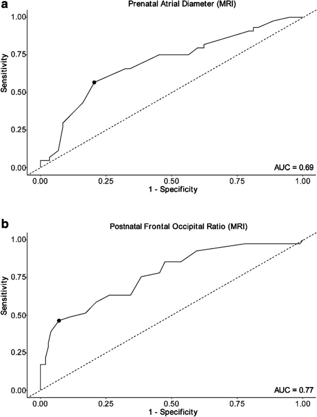 Detailed analysis of hydrocephalus patterns and associated variables in patients after open fetal repair and postnatal myelomeningocele/myeloschisis closure.