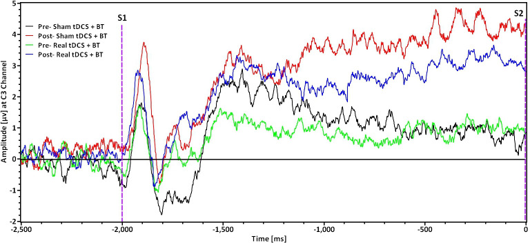 No additive effect of transcranial direct current stimulation on balance exercises for brain activity and clinical outcomes in patients with chronic ankle instability: a randomised controlled trial.