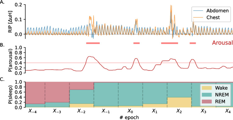 Detecting arousals and sleep from respiratory inductance plethysmography.