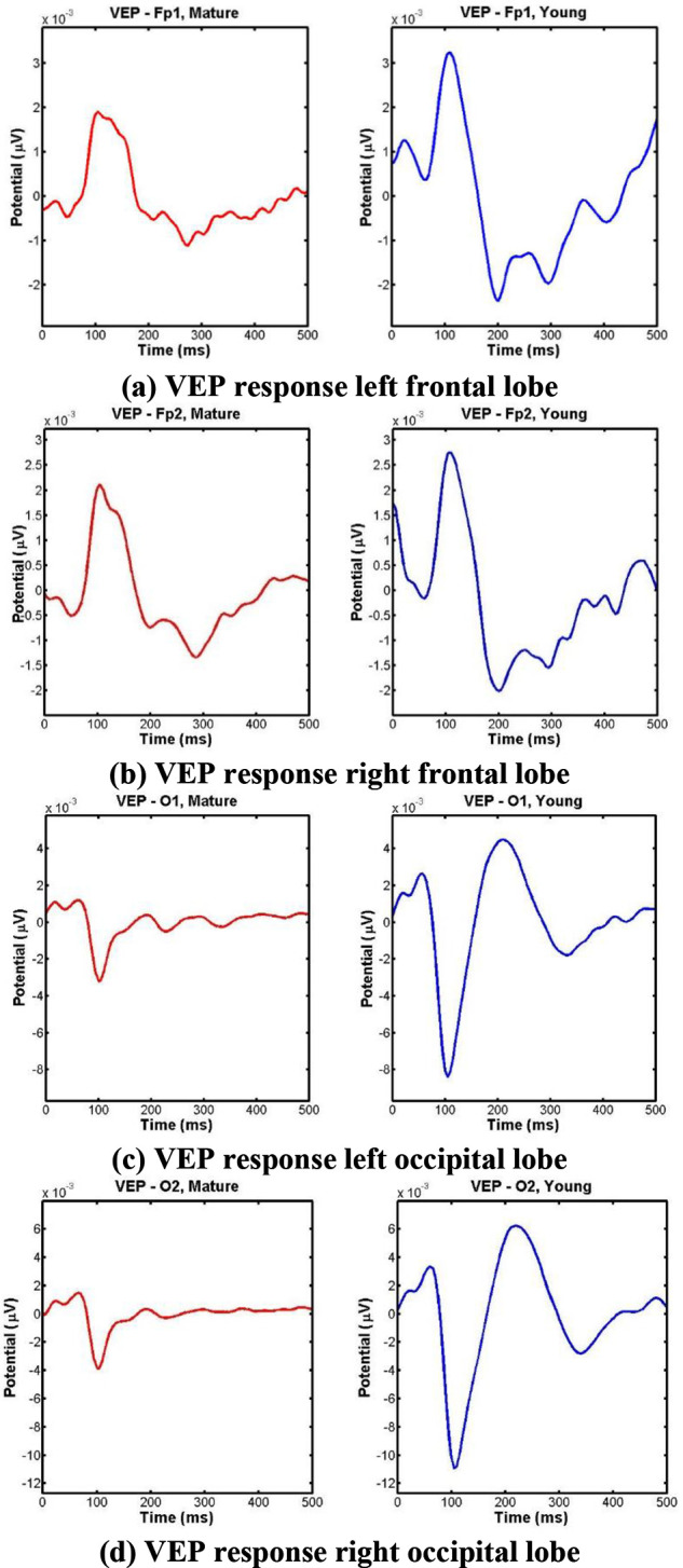 Age-Related Discrimination of Visual-Evoked Potentials Using Cross-Coherence Analysis.
