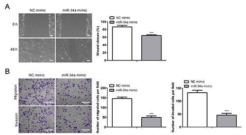 Cancer cell-derived exosomal miR-34a inhibits the malignant progression of pancreatic adenocarcinoma cells by restraining the M2 polarization of macrophages.