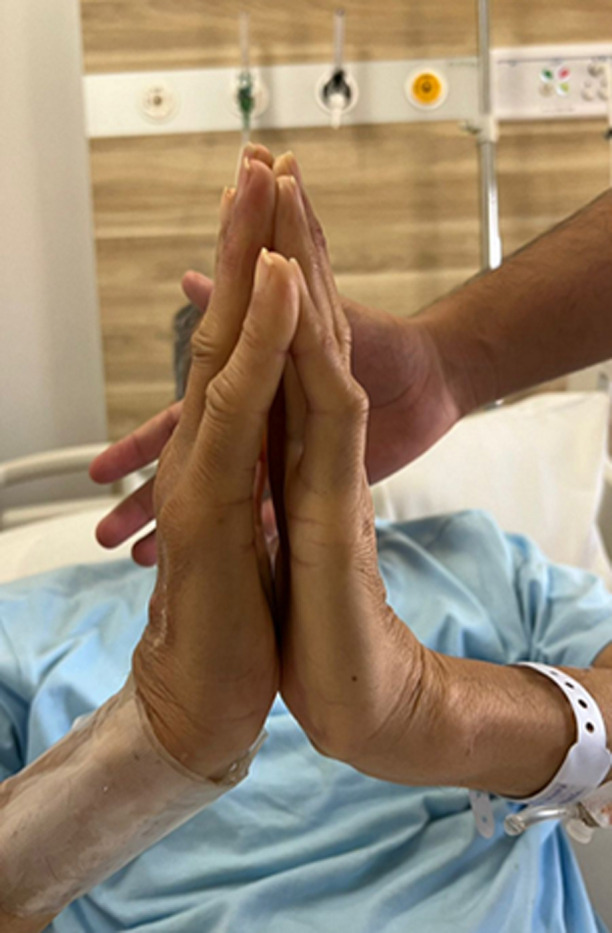 Limited joint mobility syndrome: a striking clinical sign not to be missed.