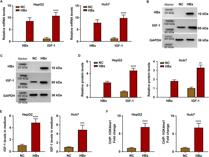 HBx/WDR5 enhances IGF-1 transcription in hepatocellular carcinoma cells and promotes recruitment, infiltration, and activity of Treg cells.