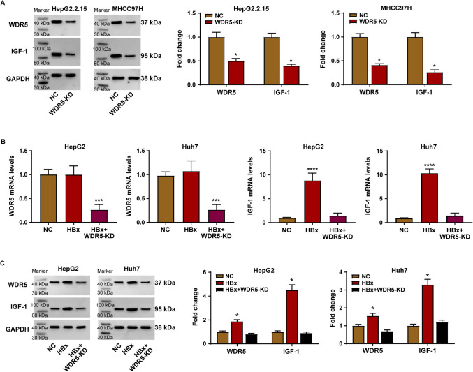 HBx/WDR5 enhances IGF-1 transcription in hepatocellular carcinoma cells and promotes recruitment, infiltration, and activity of Treg cells.
