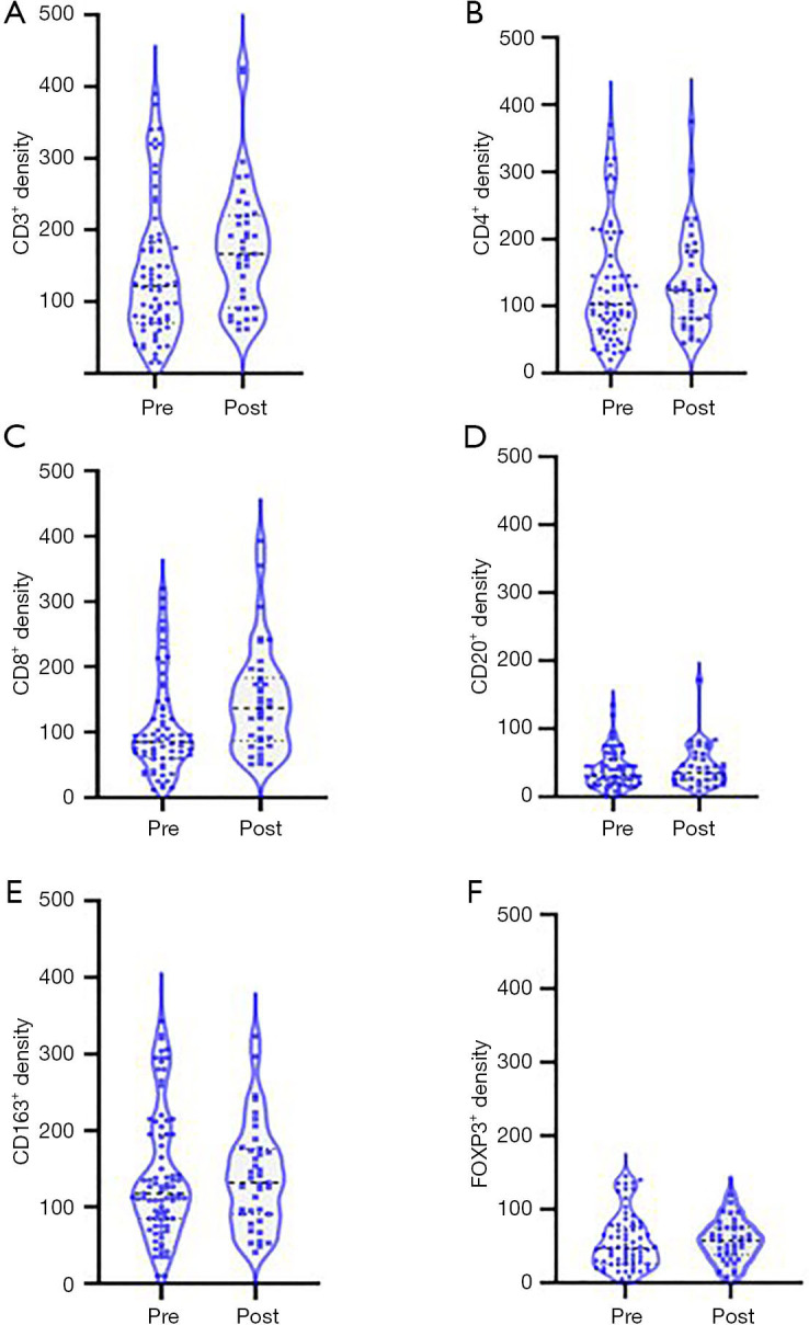Correlation study of tumor-infiltrating lymphocytes (TILs) and subtypes analysis before and after neoadjuvant chemotherapy in triple-negative breast cancer.