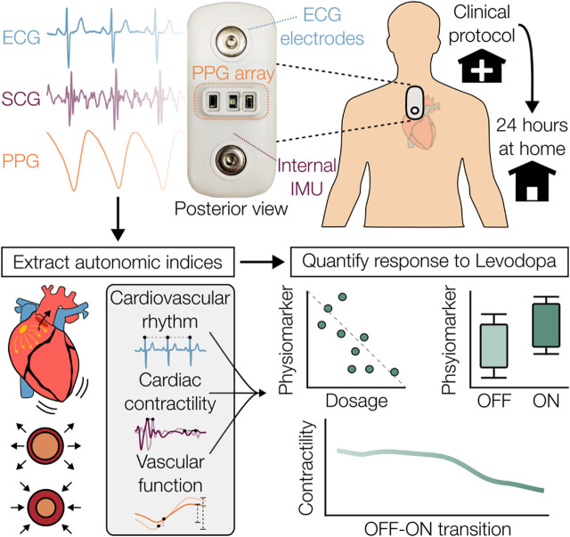 Wearable multimodal sensing for quantifying the cardiovascular autonomic effects of levodopa in parkinsonism.