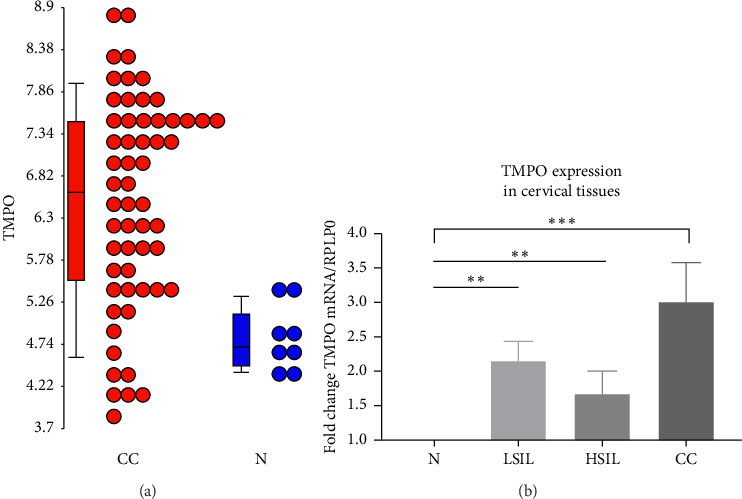 Thymopoietin-<i>α</i>, -<i>β</i>, and -<i>γ</i> Isoforms Increased Expression in Cervical Cancer Cells.