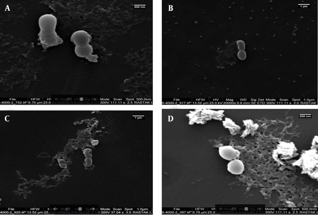 Evaluation of Antimicrobial Activity of Novel Chimeric M-PEX12 Peptide Against <i>Acinetobacter baumannii</i>.