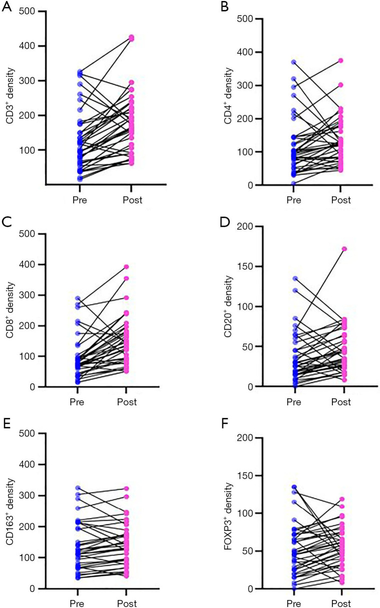 Correlation study of tumor-infiltrating lymphocytes (TILs) and subtypes analysis before and after neoadjuvant chemotherapy in triple-negative breast cancer.