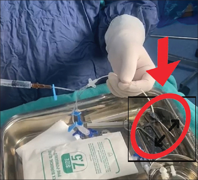 Communication Between Vascular Catheter Lumens: Safety Implications.