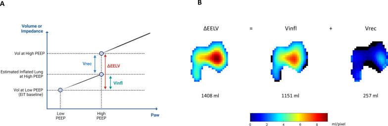Intracranial response to positive end-expiratory pressure is influenced by lung recruitability and gas distribution during mechanical ventilation in acute brain injury patients: a proof-of-concept physiological study.