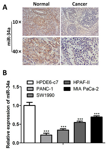 Cancer cell-derived exosomal miR-34a inhibits the malignant progression of pancreatic adenocarcinoma cells by restraining the M2 polarization of macrophages.