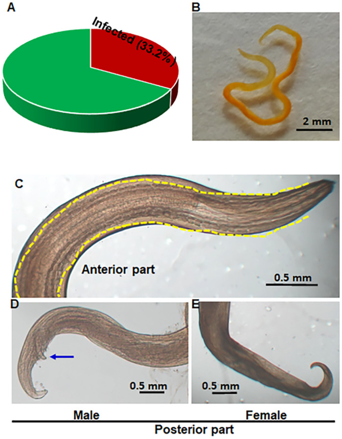 <i>Cheilospirura hamulosa</i> (Nematoda: Acuariidae) infection in indigenous chickens in Bangladesh: epidemiology, pathology and anthelmintic efficacy.
