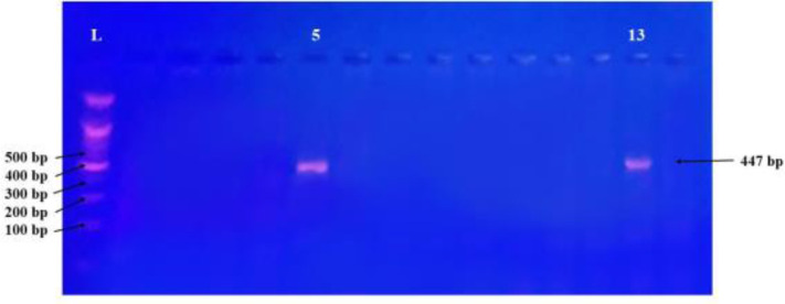 Phenotypic and genotypic characterization of carbapenemase-producing <i>Escherichia coli</i> clinical isolates in Thi-Qar, Iraq.