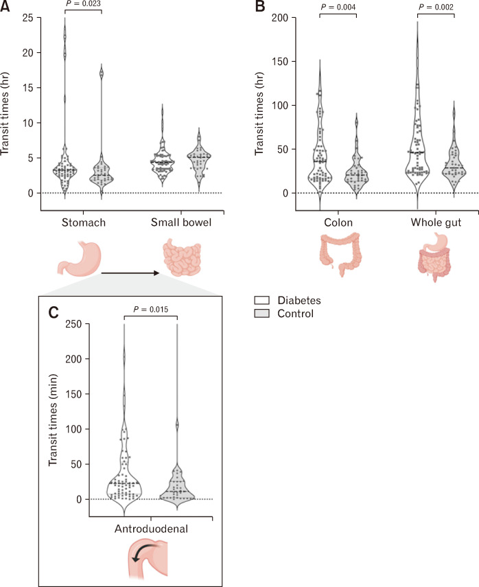 Panenteric Transit Times and Contractile Activity in Diabetic Gastroenteropathy.