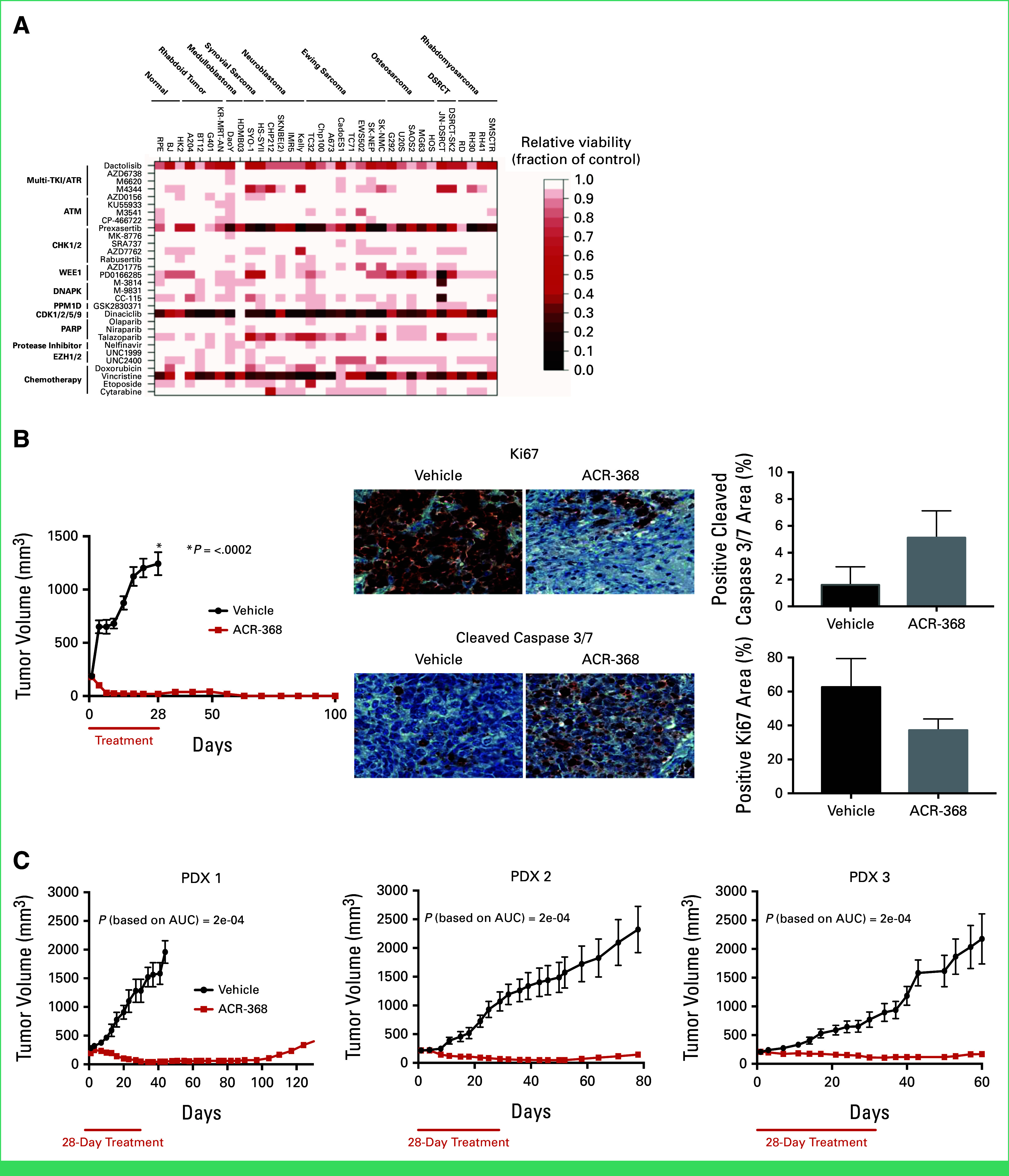 ACR-368, a CHK1/2 Kinase Inhibitor, in Patients With Relapsed or Refractory Desmoplastic Small Round Cell Tumor: Phase I/II Trial Results.