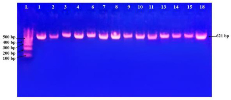 Phenotypic and genotypic characterization of carbapenemase-producing <i>Escherichia coli</i> clinical isolates in Thi-Qar, Iraq.