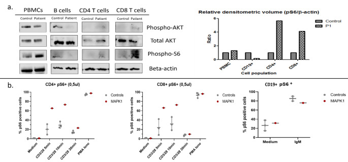 A Novel Description of Immunodeficiency and Immune Dysregulation in a 14-Year-Old Girl with Noonan Syndrome 13.