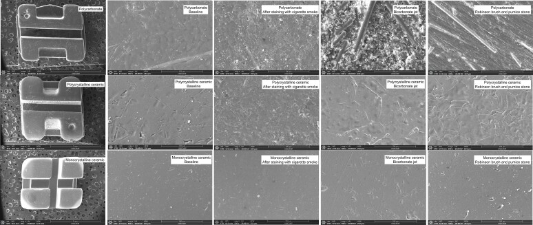 Color change and surface degradation of esthetic brackets after exposure to cigarette smoke and two cleaning treatments.