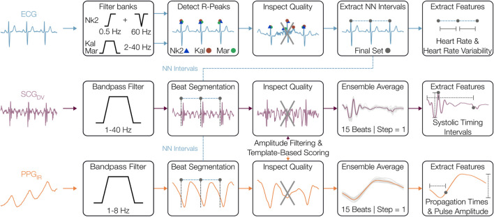 Wearable multimodal sensing for quantifying the cardiovascular autonomic effects of levodopa in parkinsonism.