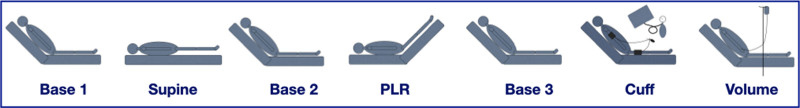 Improved Prediction of Fluid Responsiveness in Ventilated Patients With Low Tidal Volume: The Role of Preload Variation.