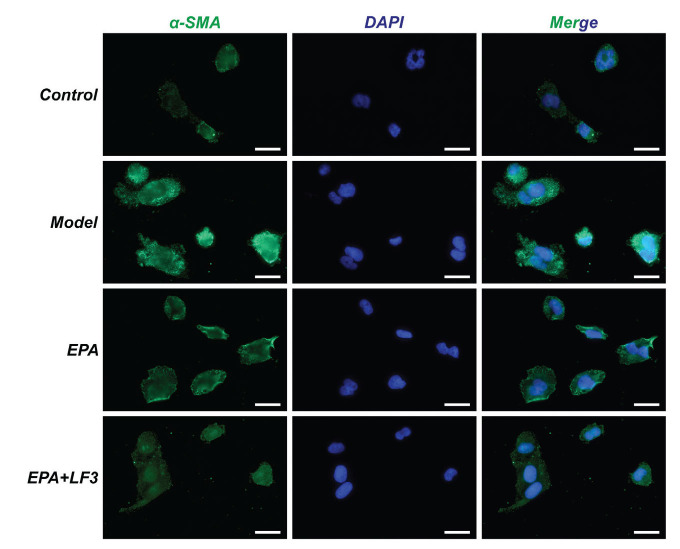 Eicosapentaenoic Acid Modulates TGF-β1/Smad3/ILK Pathway to Attenuate Renal Fibrosis: A Biotechnological Approach.
