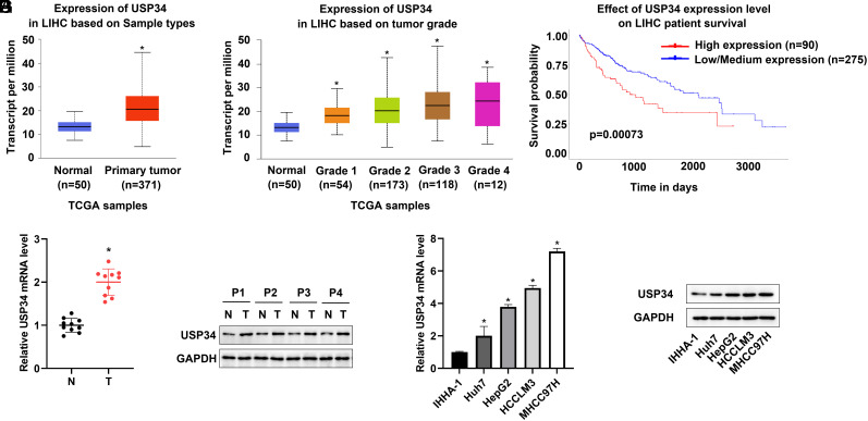 The Knockdown of USP34 Inhibits the Progression of Hepatocellular Carcinoma by Accelerating c-Myc Degradation.