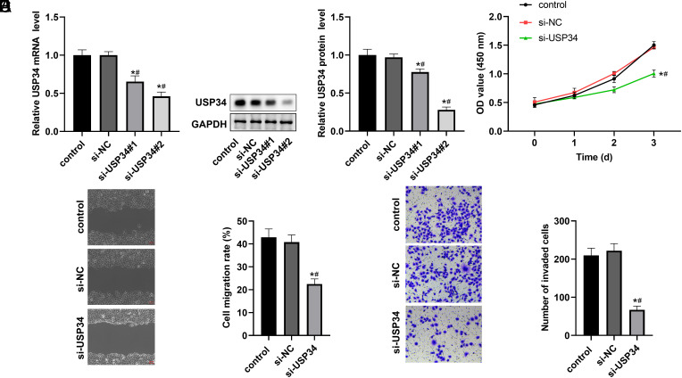 The Knockdown of USP34 Inhibits the Progression of Hepatocellular Carcinoma by Accelerating c-Myc Degradation.
